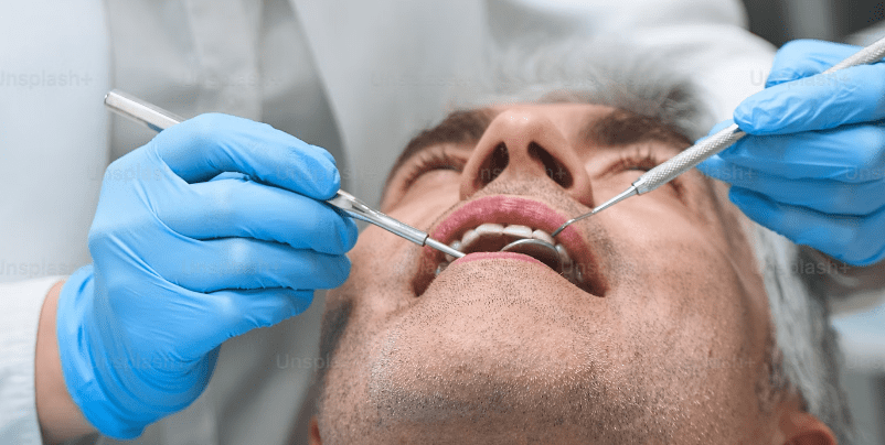 Root Canal Treatment in Paschim Vihar