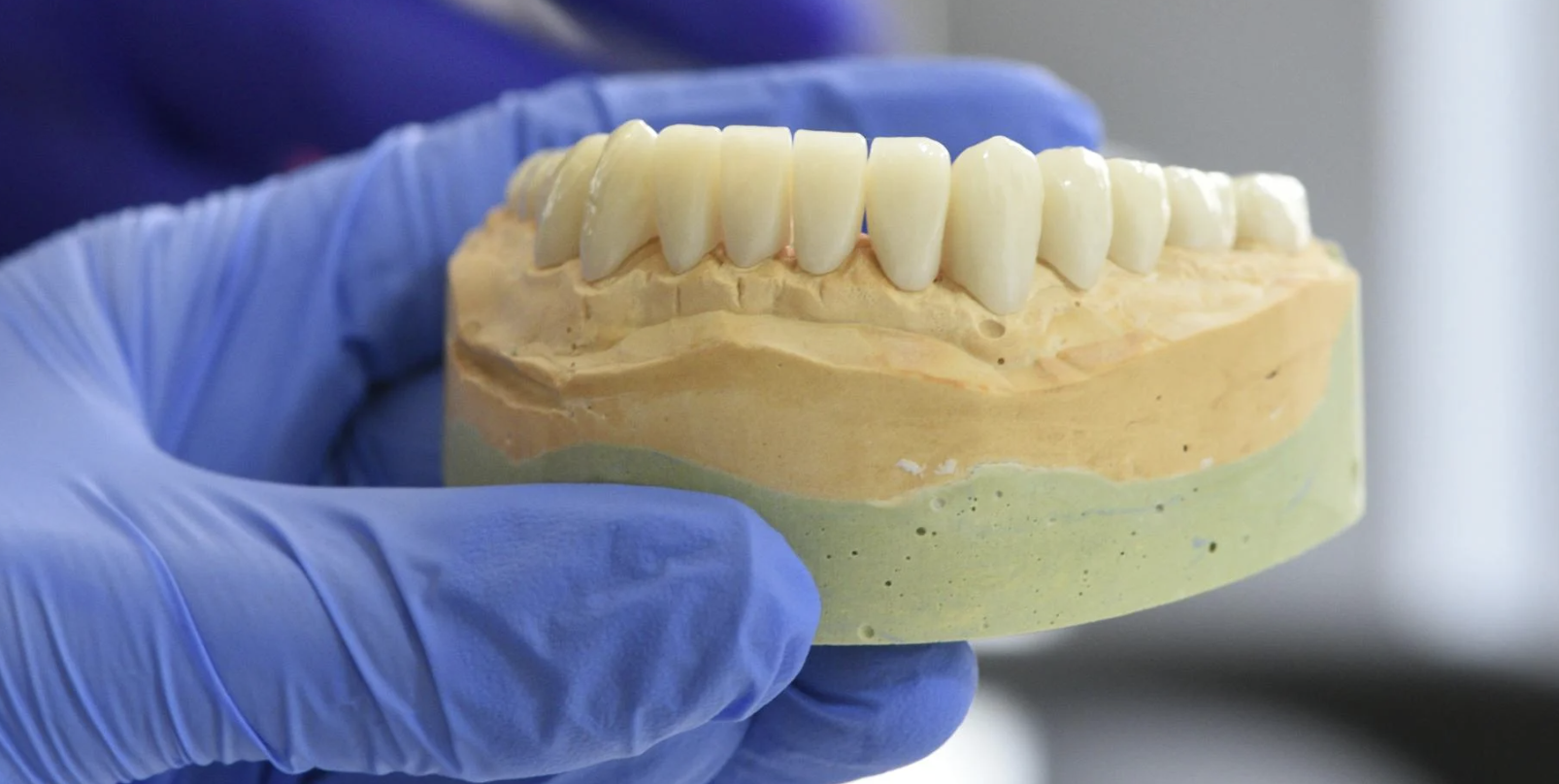 Dentures vs Dental Implants