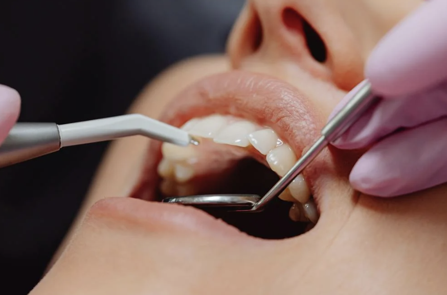 Gum Disease Treatment