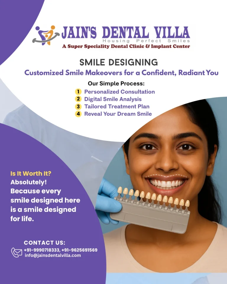 Smile designing