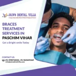 Braces treatment in paschim vihar