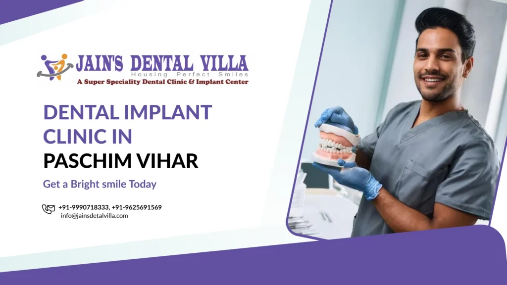 dental implants