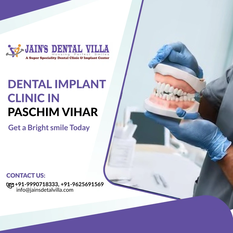 dental implants clinic in paschim vihar