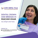 dental crowns & bridges in paschim vihar