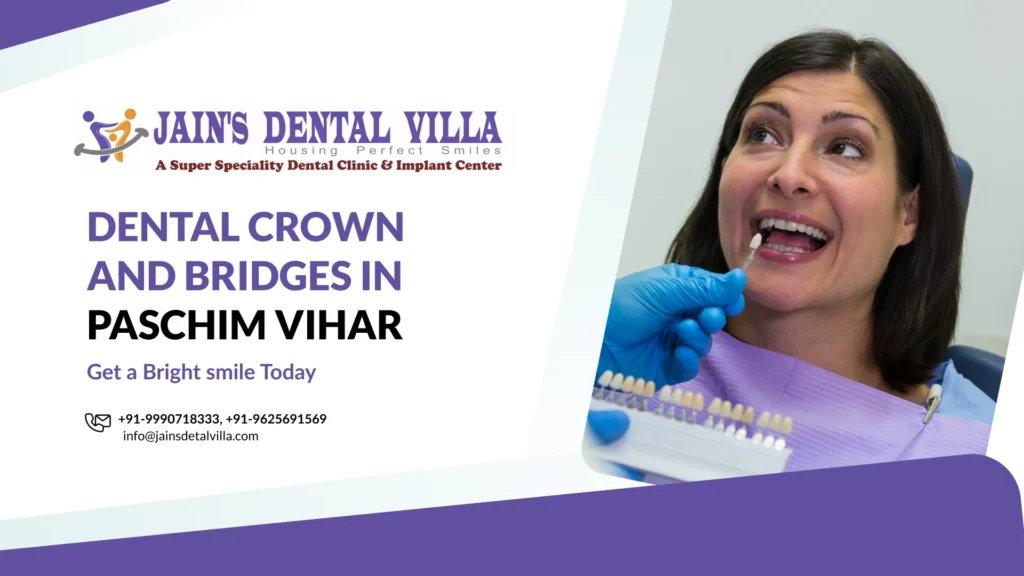 dental crowns and bridges in paschim vihar