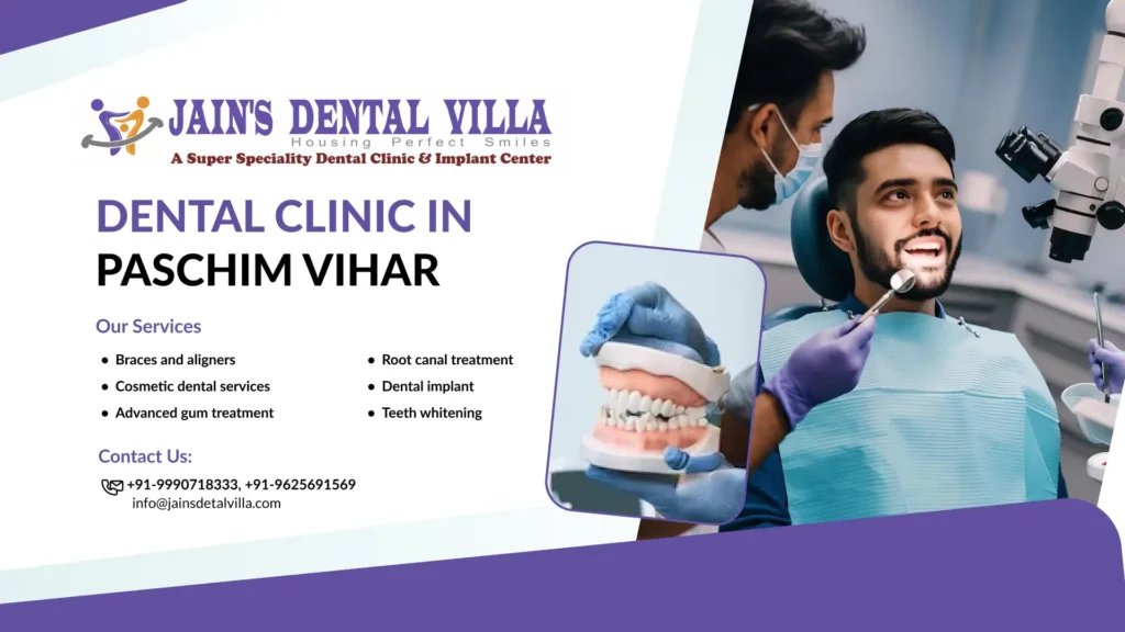Dental Clinic in paschim vihar