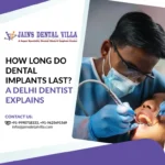 How Long Do Dental Implants Last