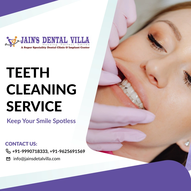 teeth cleaning service