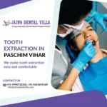 Tooth extraction in paschim vihar 1
