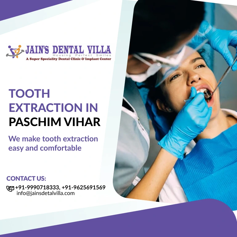Best Tooth Extraction in Paschim Vihar