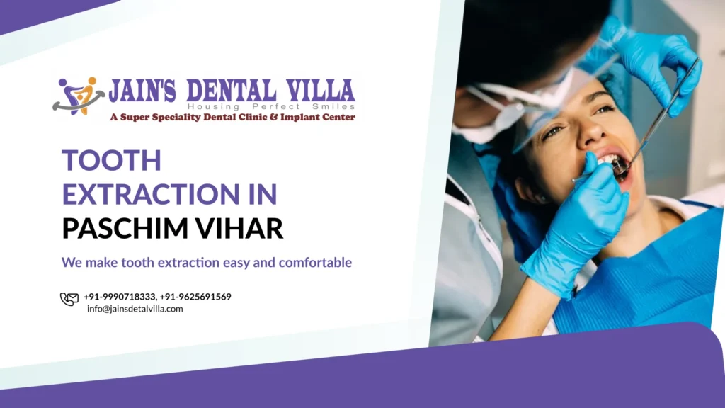 tooth extraction in pashim vihar
