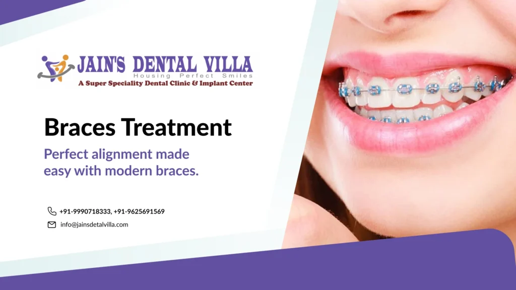 Braces treatment1