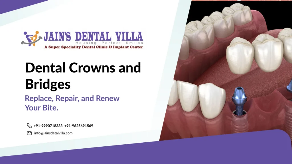 Dental crowns and bridges