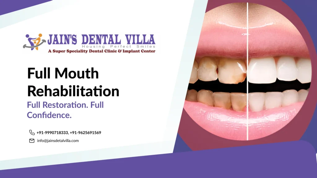 Full mouth rehabilitation