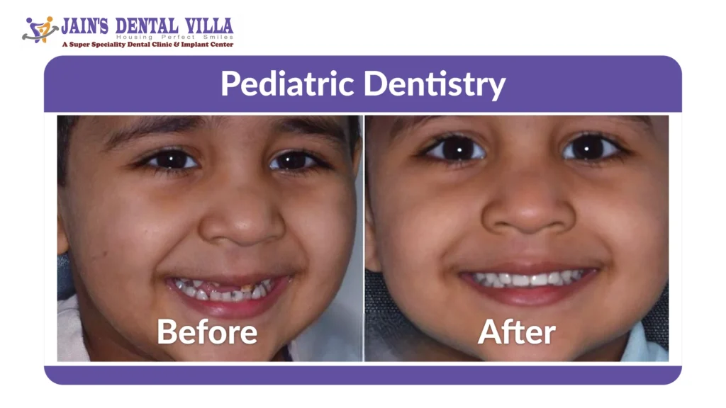 Before and after pediatic dentistry