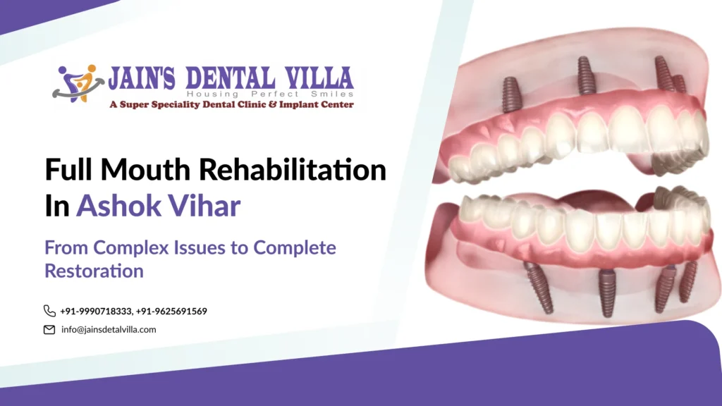 full mouth rehabilitation in ashok vihar