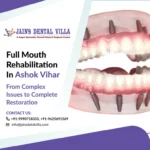 full mouth rehabilitation in our ashok vihar branch