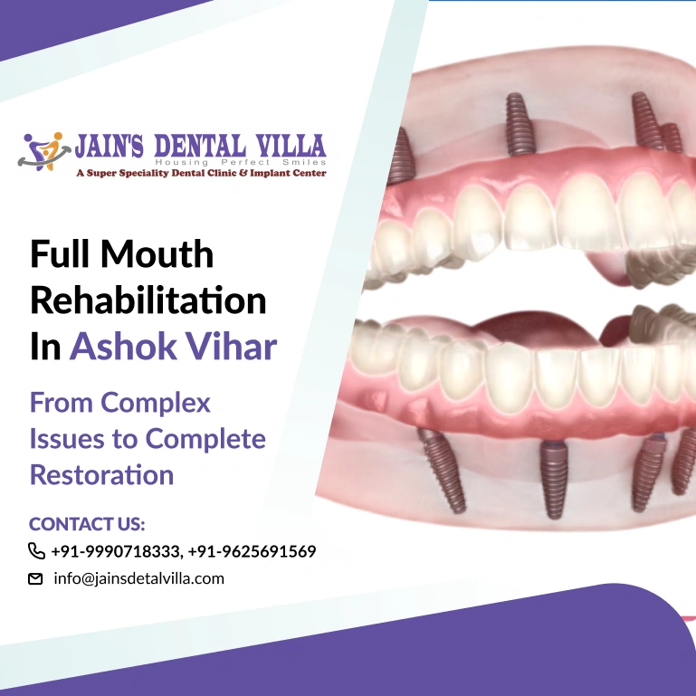 full mouth rehabilitation in our ashok vihar branch
