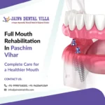 full mouth rehabilitation in paschim vihar