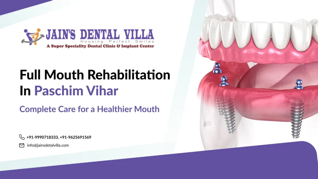 Full Mouth Rehabilitation in Paschim Vihar (2)