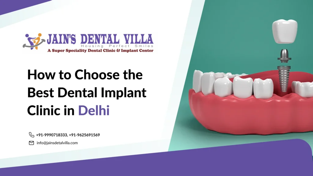 how to choose the best dental implant clinic in delhi