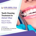 Teeth Cleaning in Ashok Vihar