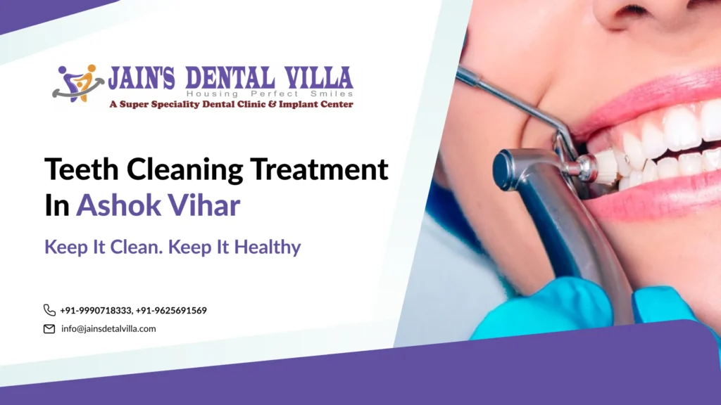Teeth Cleaning in Ashok Vihar