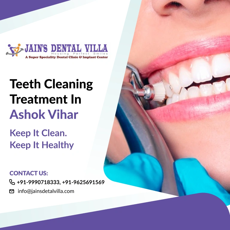 Teeth Cleaning in Ashok Vihar