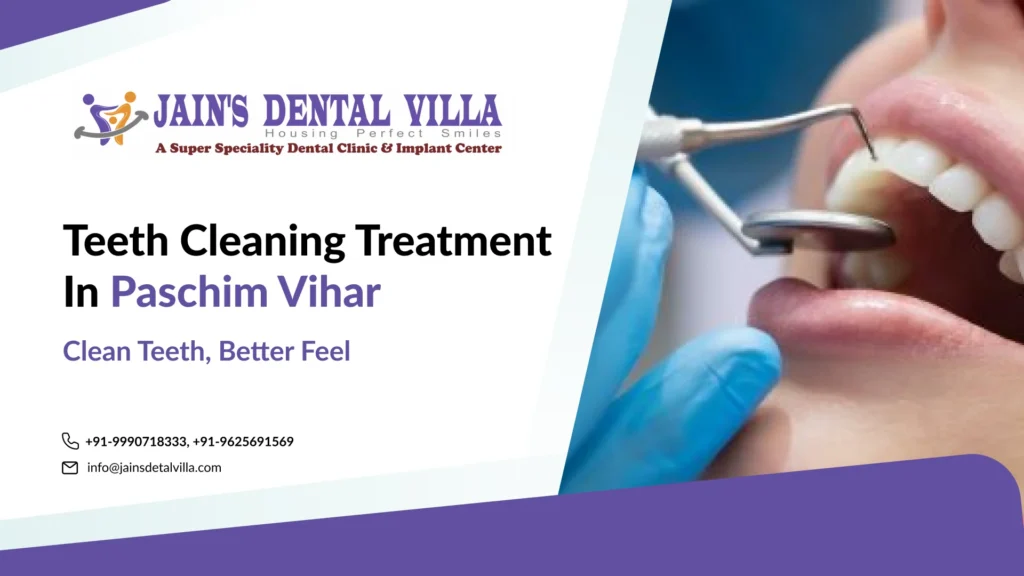 Teeth Cleaning in Paschim Vihar