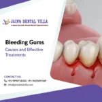 bleeding gum causes and treatment