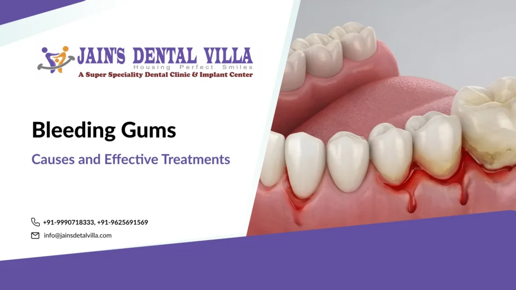 Bleeding Gums Causes and Effective Treatments