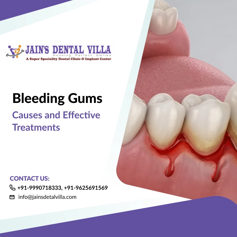 bleeding gum causes and treatment