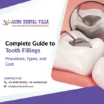 Complete Guide to Tooth Fillings Procedure, Types, and Cost (2)