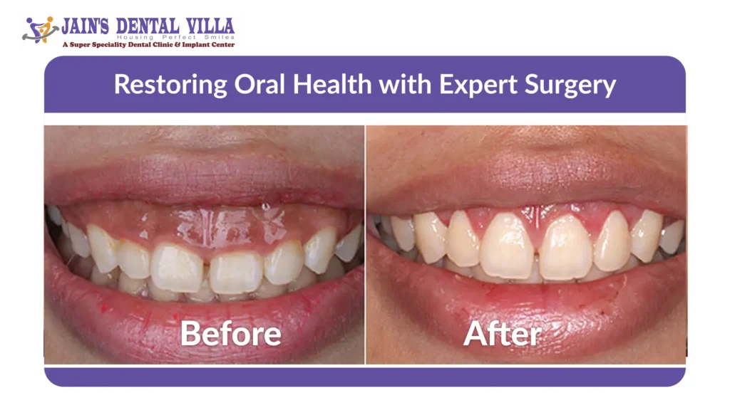 dental surgery before and after image