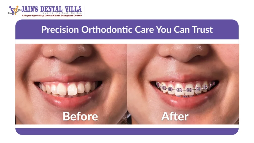 Orthodontist before and after image