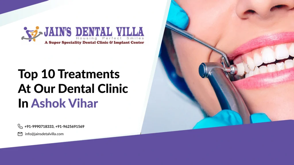 Top 10 Treatments at Our Dental Clinic in Ashok Vihar