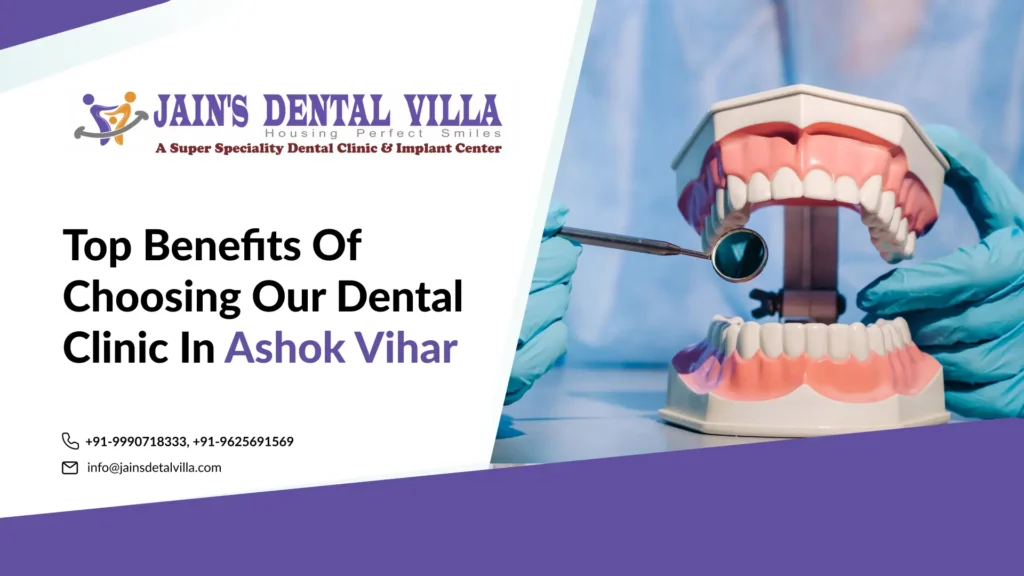 top benefits of choosing our dental clinic in ashok vihar