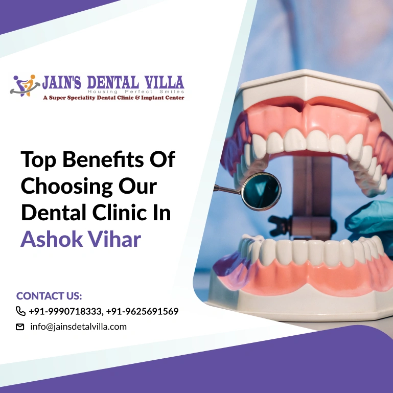 benefits of choosing our dental clinic in ashok vihar