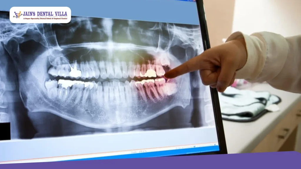 Digital x ray shown on the screen