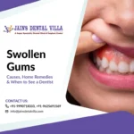 Swollen Gums Causes, Home Remedies & When to See a Dentist
