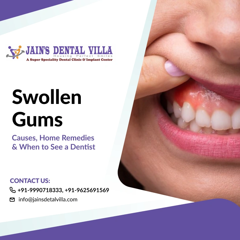 Swollen Gums Causes, Home Remedies & When to See a Dentist