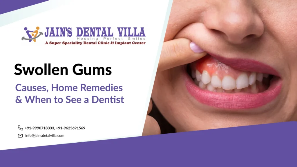 Swollen Gums Causes, Home Remedies & When to See a Dentist